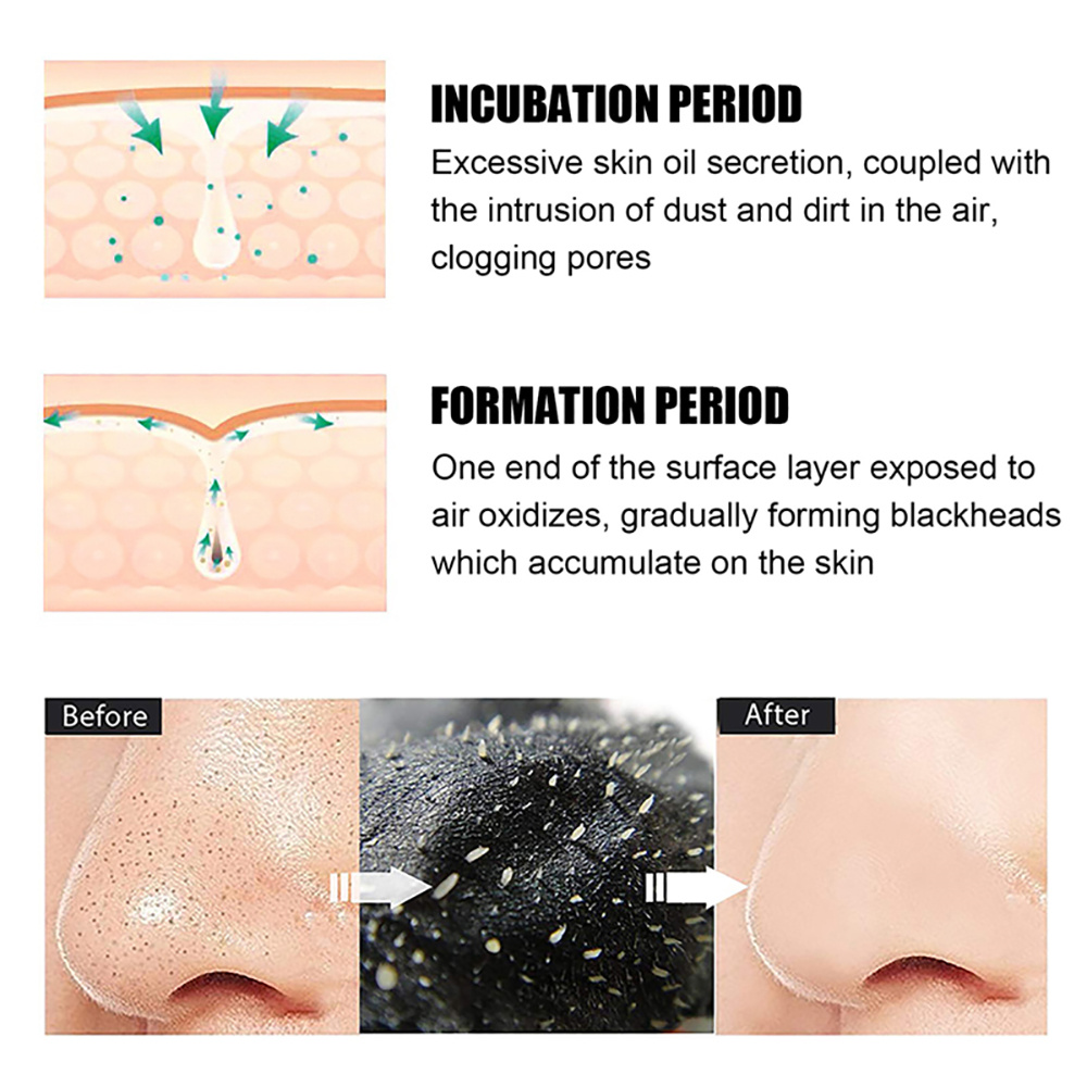 10-100Pcs Blackhead Remover Ma - Nasal Aspirator recension och pris
